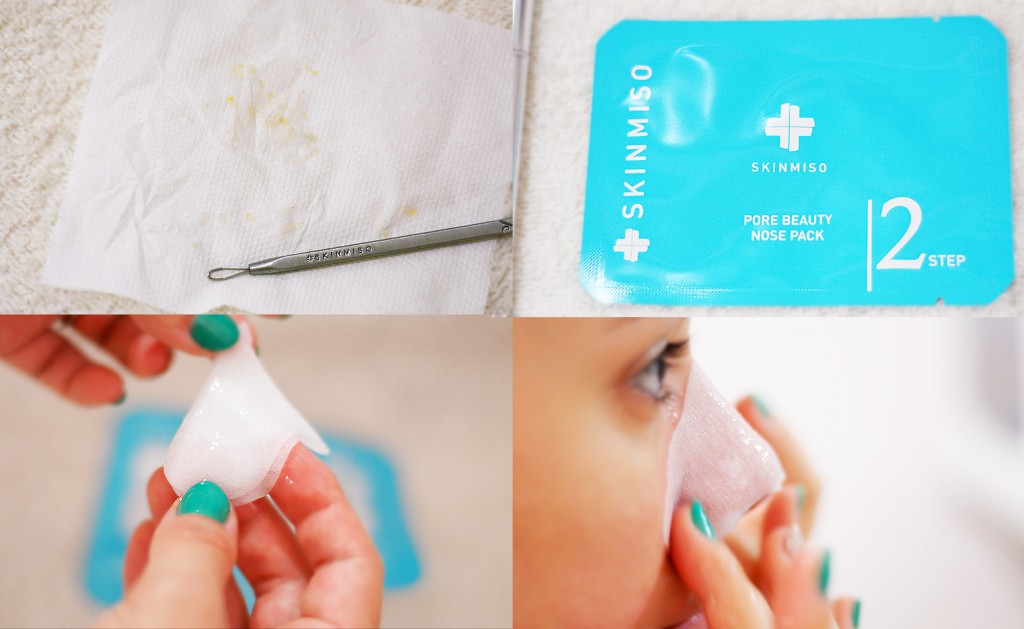 Remove Blackheads | Skinmiso Pore Beauty Nose Pack Review