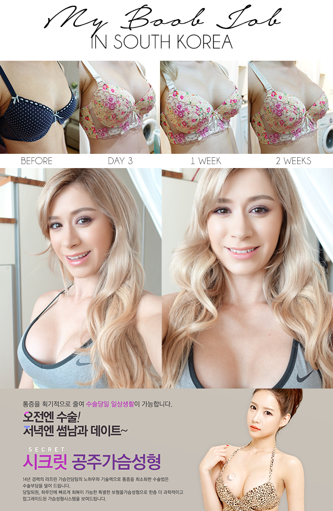 BOOB JOB IN SOUTH KOREA | My Experience at LaPrin Plastic Surgery