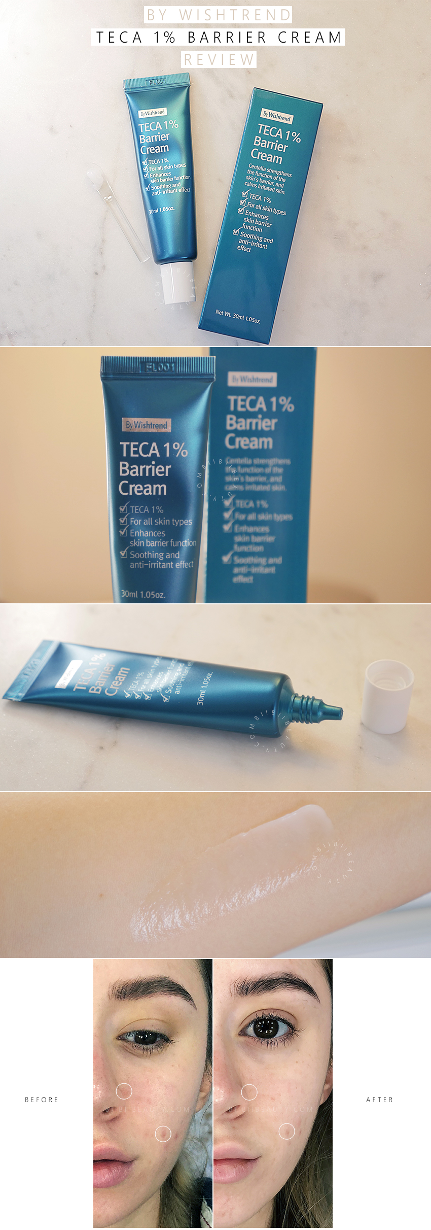 By Wishtrend Teca 1% Barrier Cream Review on Acne Prone Skin